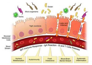 lekkende darm, leaky gut, tight junctions